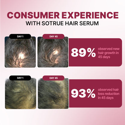 Sotrue 12% Hair Growth Actives Serum For Scalp - Redensyl, Procapil, Anagain & Baicapil
