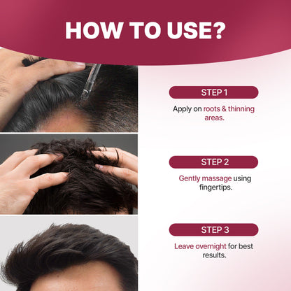 Sotrue 12% Hair Growth Actives Serum For Scalp - Redensyl, Procapil, Anagain & Baicapil