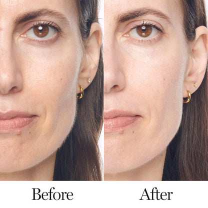 Lancome Renergie H.C.F. Triple Serum - Advanced Anti-Aging Hyaluronic Acid & Vitamin C