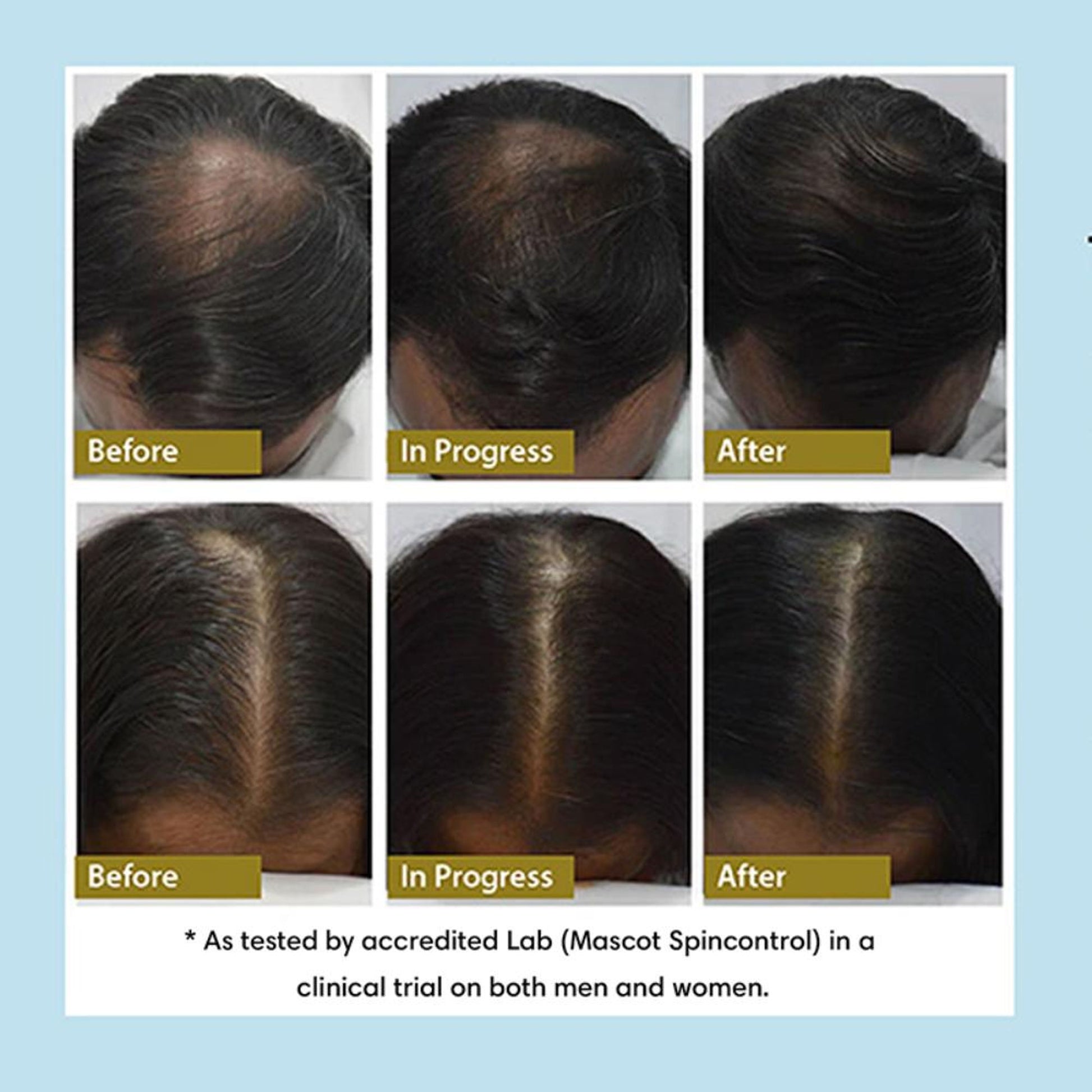 The Earth Collective Hair Density Tonic