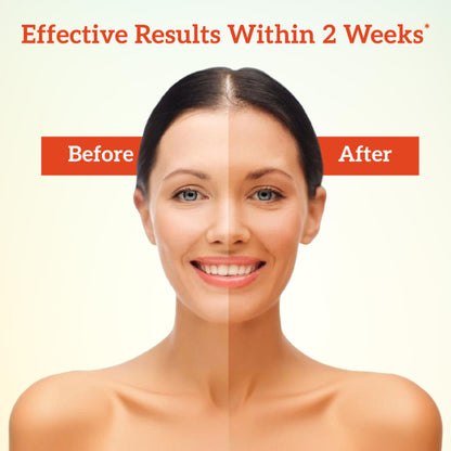 inatur Sandal Face Pack for Tan Removal, Blemish Control, with Herbal Extracts