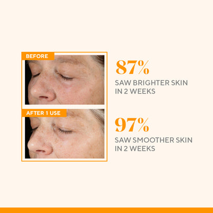 Murad Environmental Shield Vitamin C Triple Exfoliating Facial
