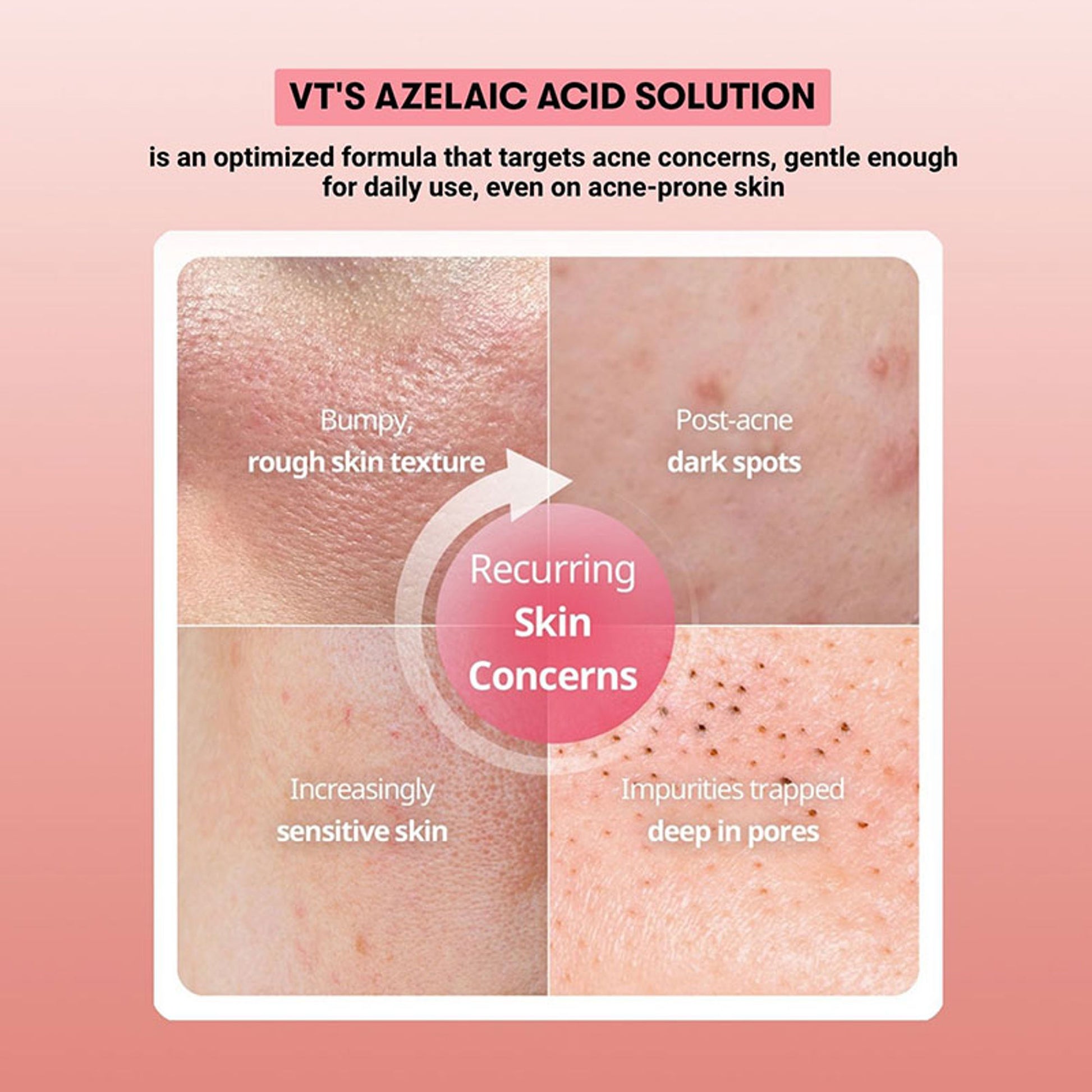 VT Cosmetics Azelaic Acid Capsule Cream