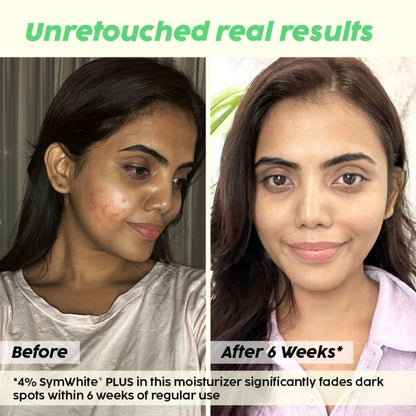 Plix 2% Alpha Arbutin Pineapple Moisturizer With SymWhite PLUS For Hyperpigmentation & Dark Spots