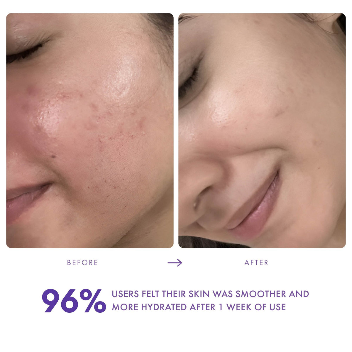Within Beauty Ceramide & Hyaluronic Acid Gel Moisturiser, Daily Dew Barrier Restore Moisturiser