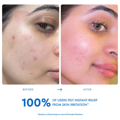 Within Beauty Ceramide & Niacinamide Serum, Calming Drops Barrier Restore Soothing Serum