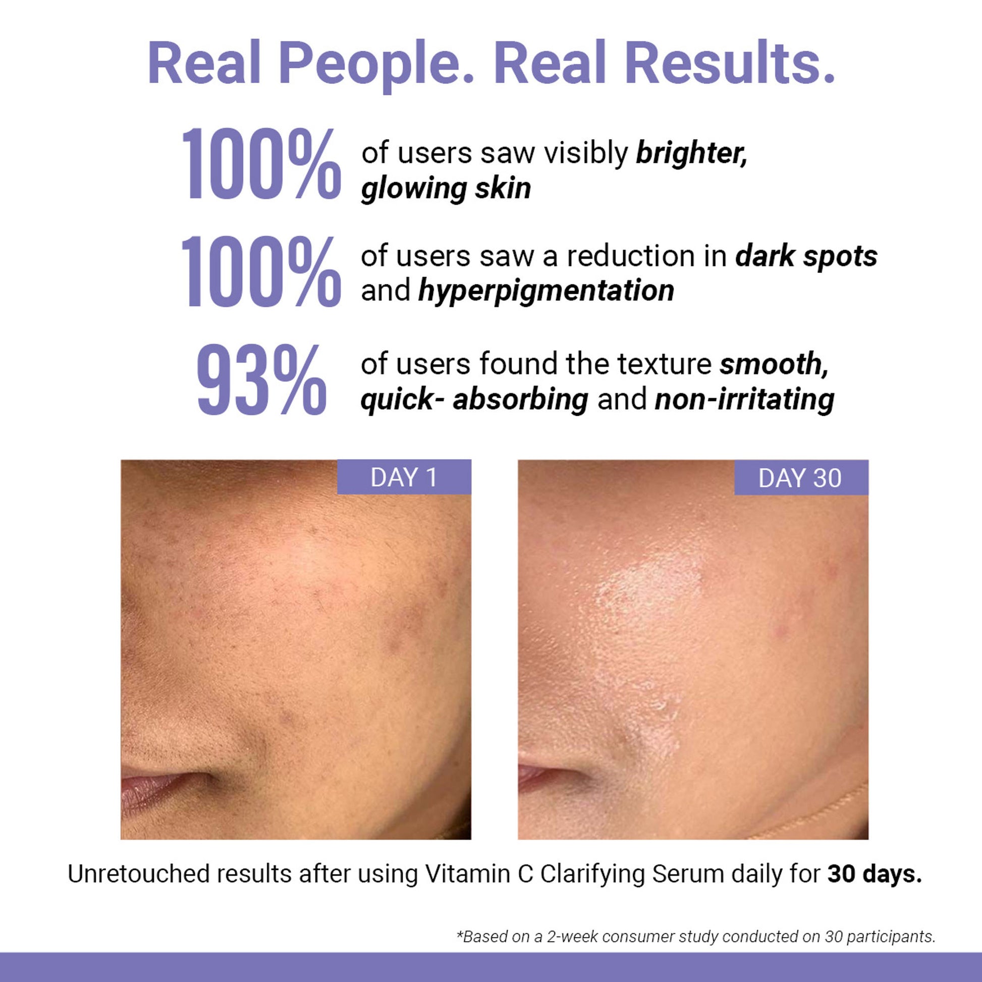 Sereko Vitamin C Clarifying Serum With Niacinamide For Glowing Skin, Fades Hyperpigmentation