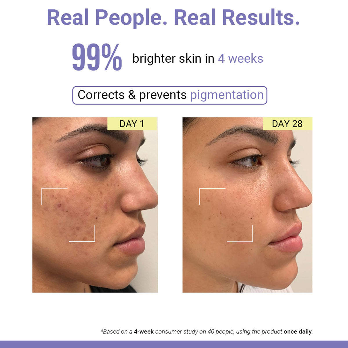 SEREKO Vit C Night Cream with Niacinamide for Tan Removal & Pigmentation