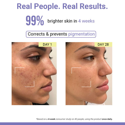 SEREKO Vit C Night Cream with Niacinamide for Tan Removal & Pigmentation