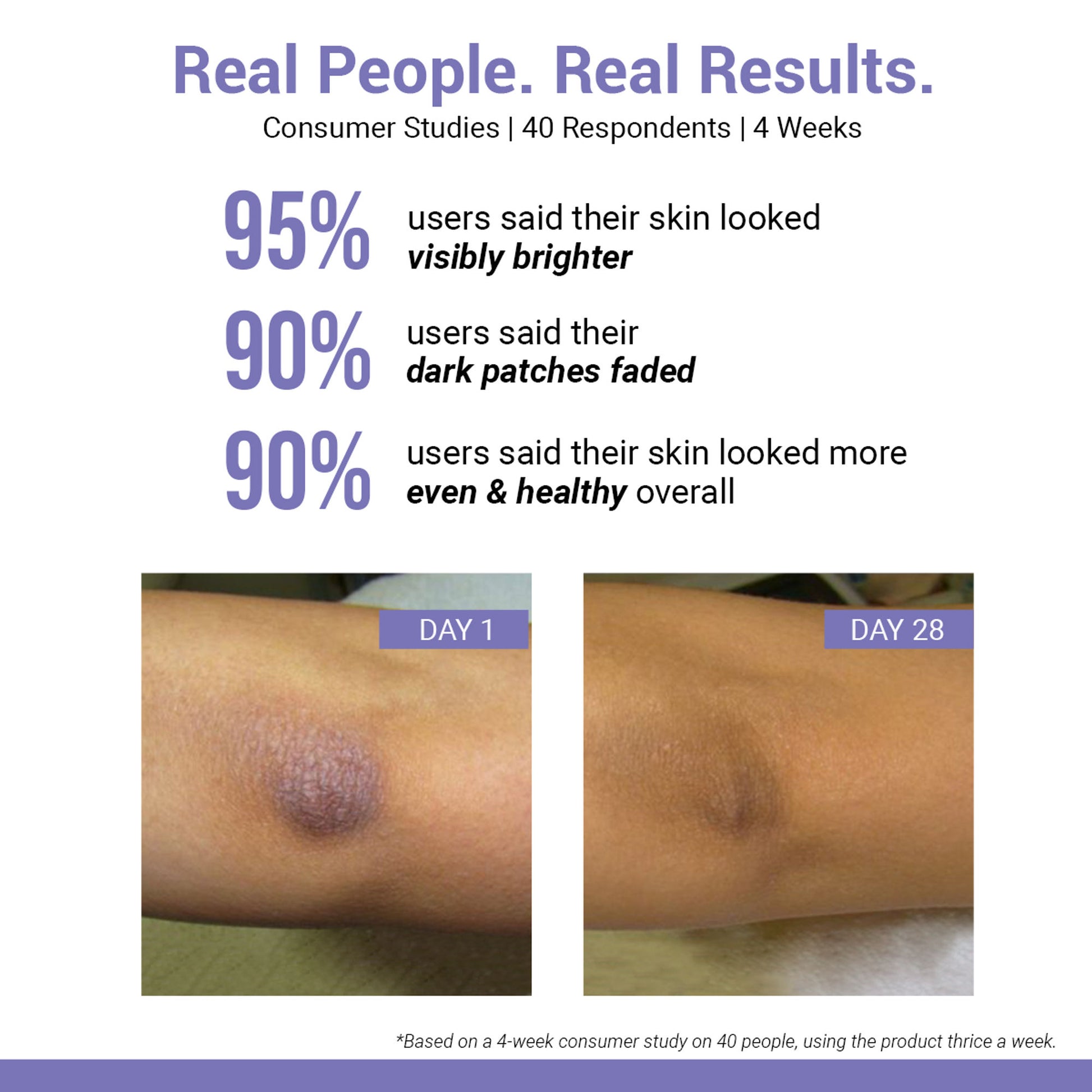 SEREKO Vitamin C Body Scrub for Tan Removal, Ingrown Hair & Body Exfoliation