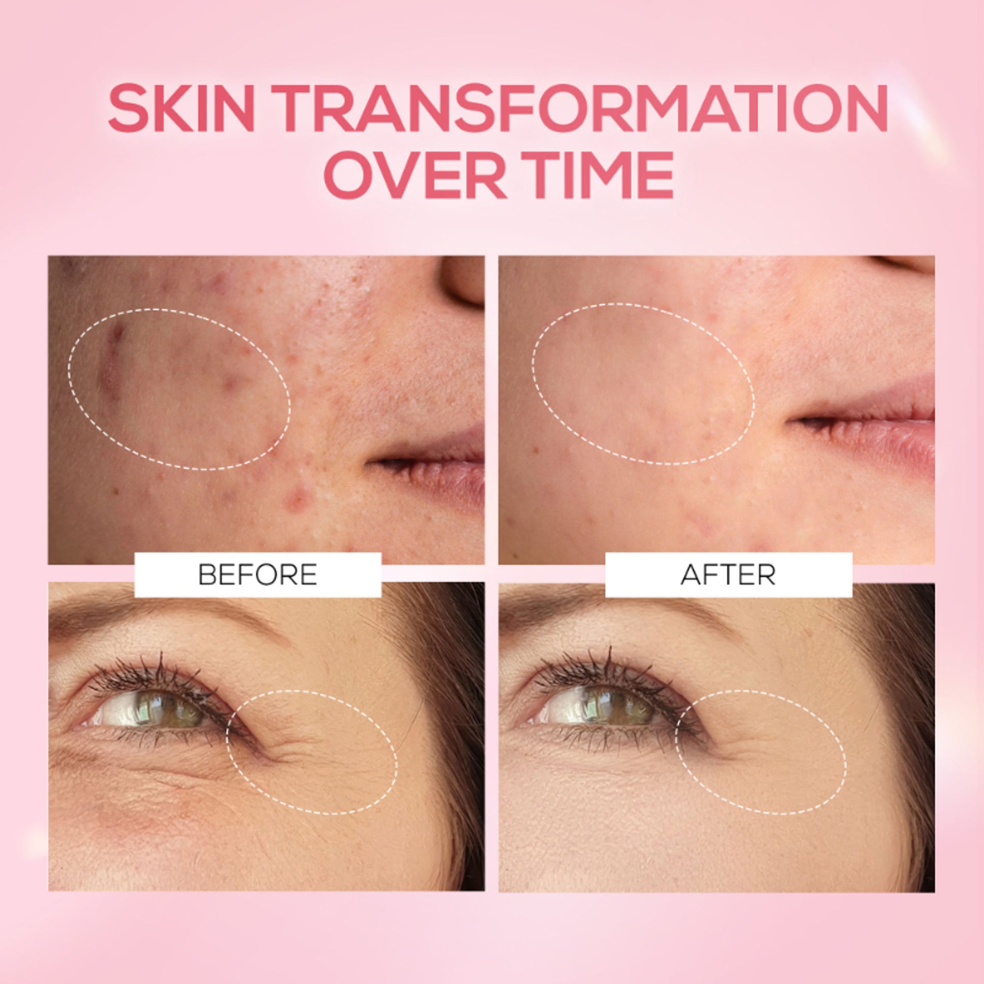 RENEE Pink Therapy PDRN Pink Peptide Face Serum For Radiant & Hydrated Skin With Hyaluronic Acid