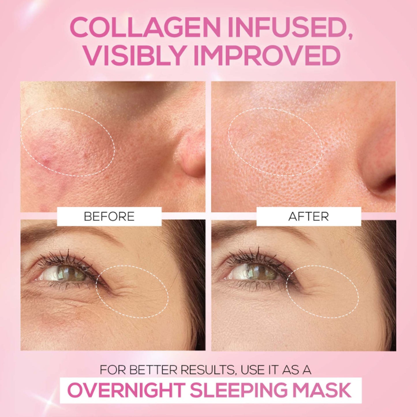 Renee Cosmetics Pink Therapy Hydrolyzed Collagen Jelly Cream