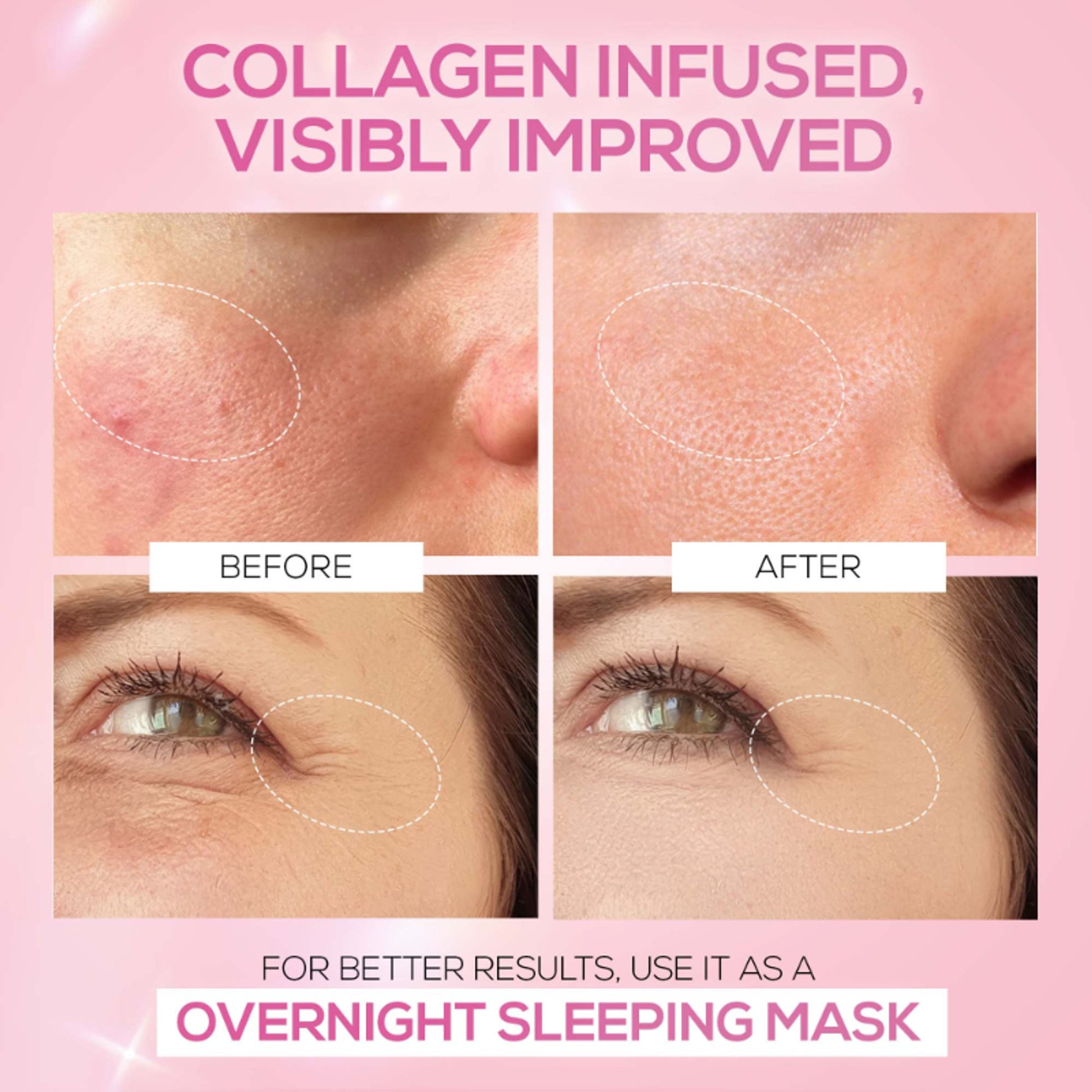 Renee Cosmetics Pink Therapy Hydrolyzed Collagen Jelly Cream