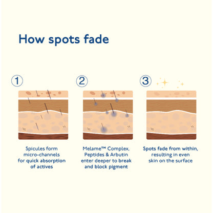 Asaya Advanced Dark Spot Gel for Pigmentation Acne Marks with MelaMe & Alpha Arbutin All Skin Type