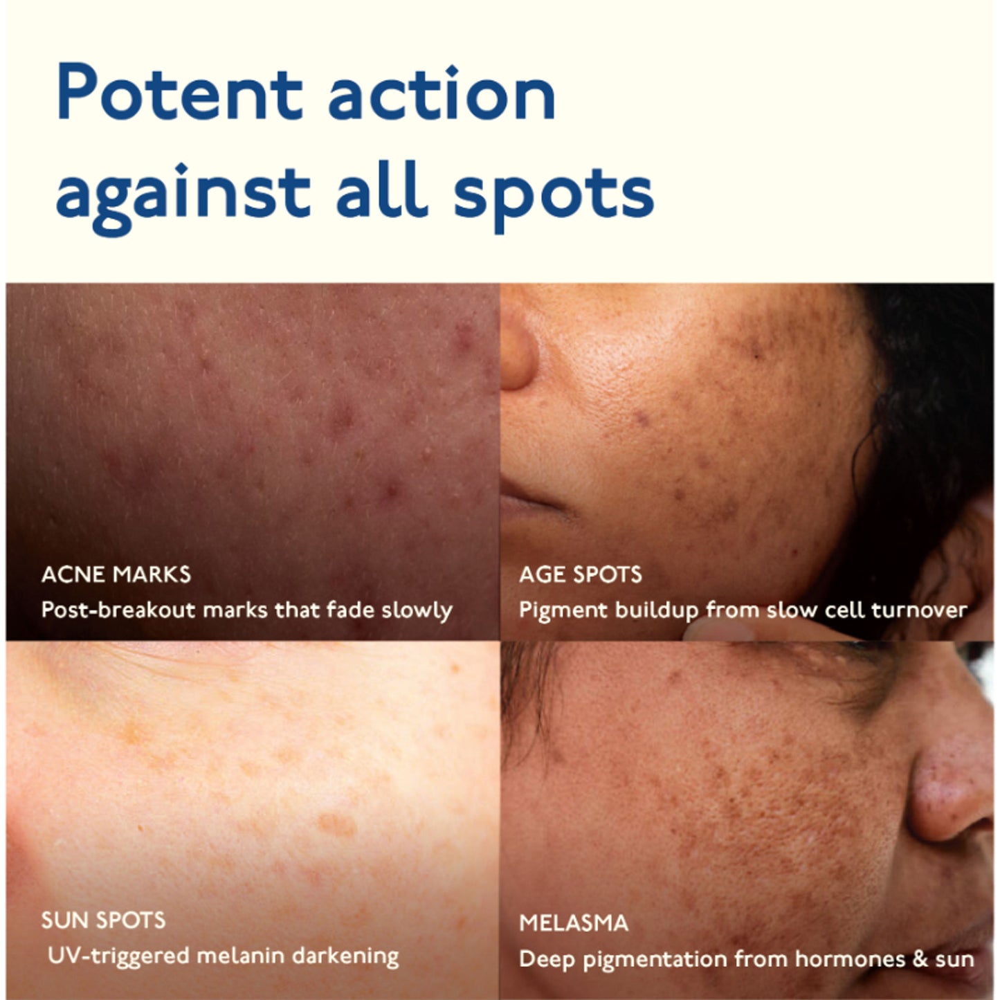 Asaya Advanced Dark Spot Gel for Pigmentation Acne Marks with MelaMe & Alpha Arbutin All Skin Type