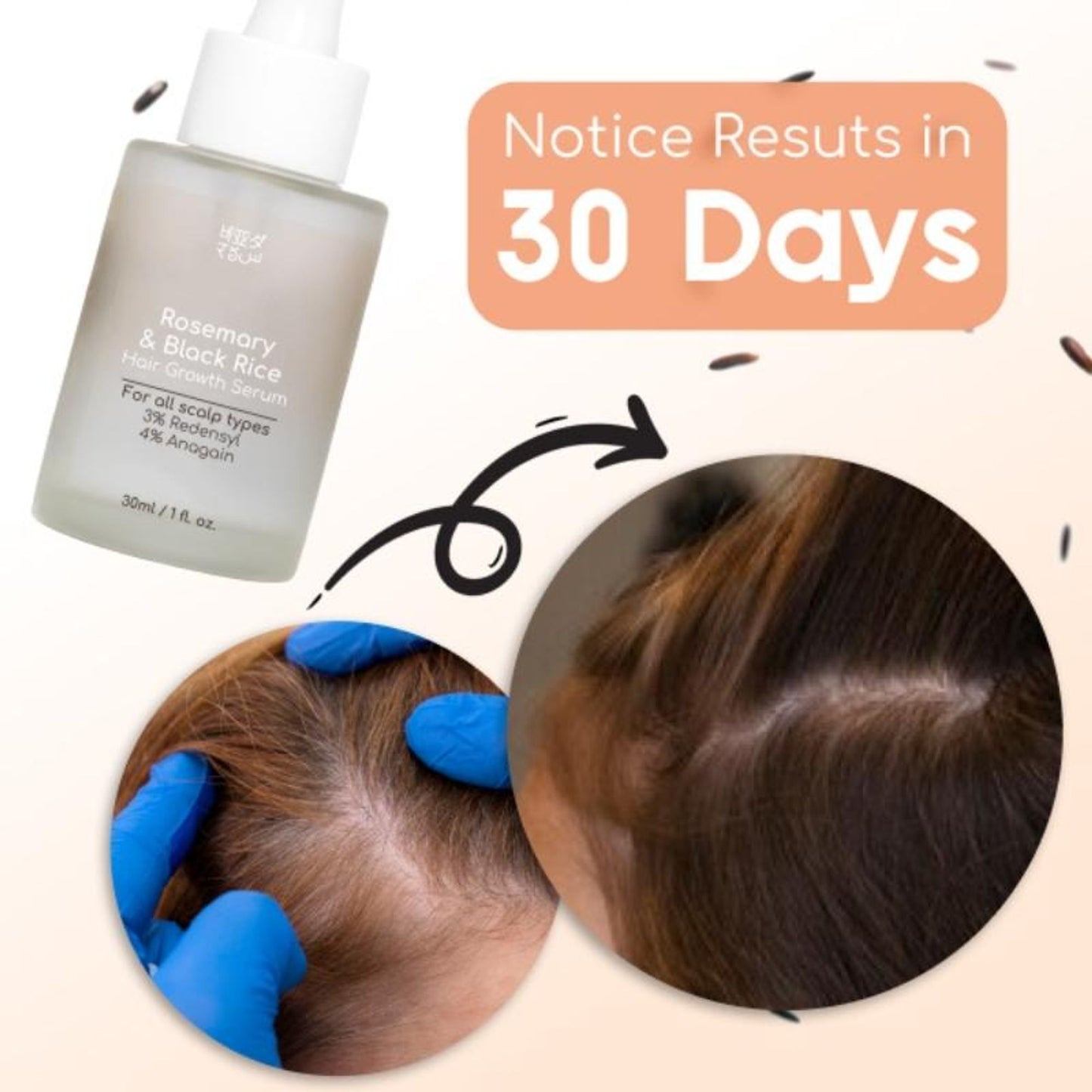 Beyond Rosemary & Black Rice Hair Growth Serum