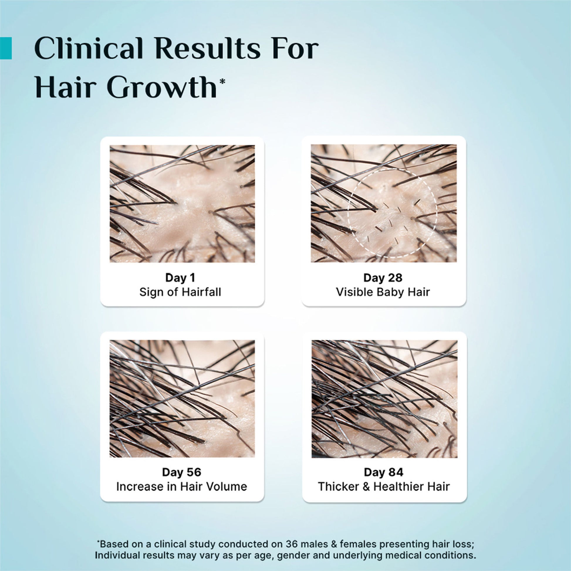 Pilgrim 3% Redensyl 4% Anagain Rosemary Korean Black Rice Advance Hair Growth Serum For Men & Women