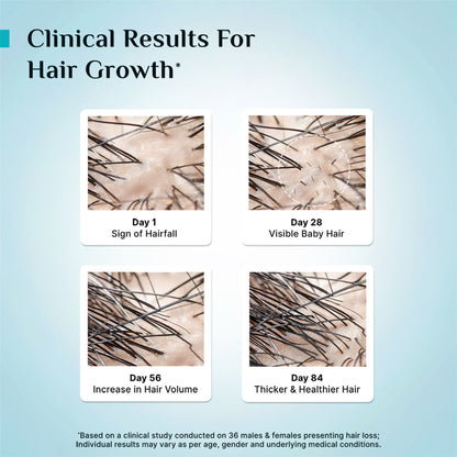 Pilgrim 3% Redensyl 4% Anagain Rosemary Korean Black Rice Advance Hair Growth Serum For Men & Women