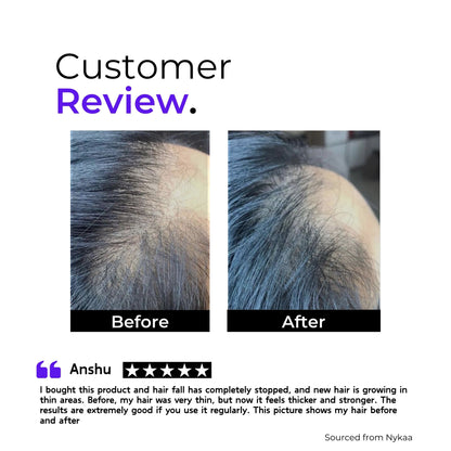 GLAD I MET YOU Hair Growth Serum