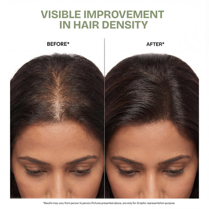 Proskire Ultimate Hair Growth Oil