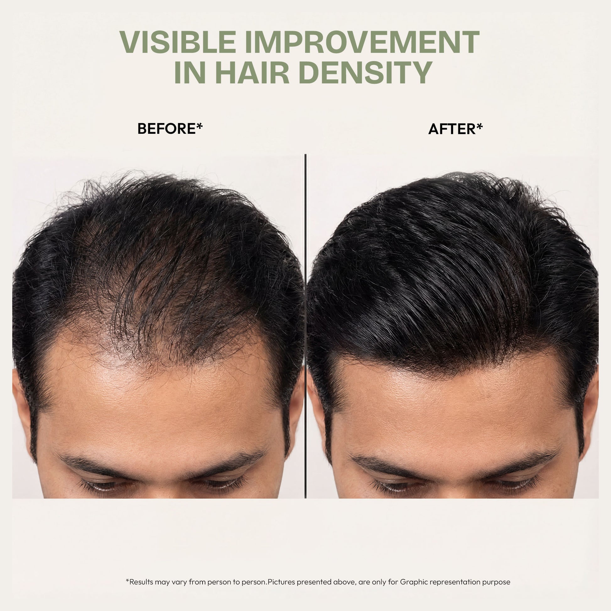 Proskire Ultimate Hair Growth Oil