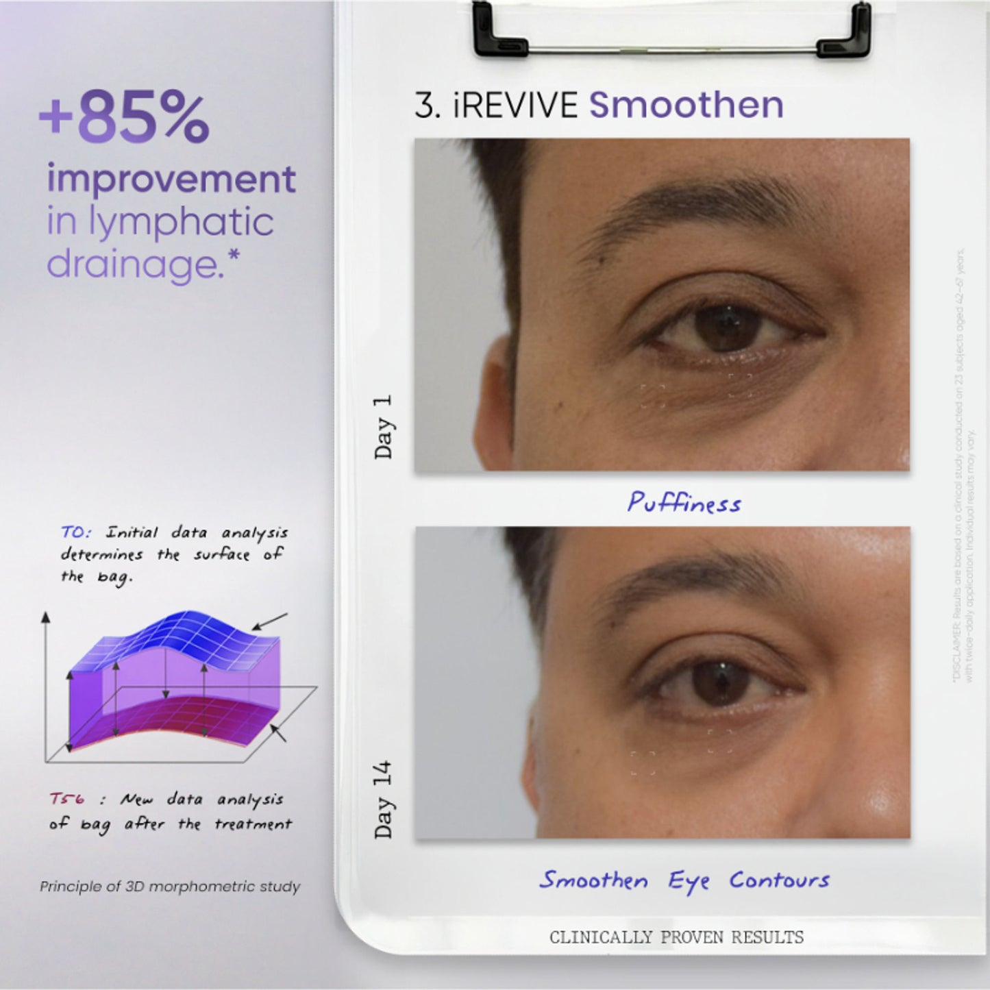 SkinInspired iREVIVE Dual Chamber Under Eye Serum, Brightening & De-Puffing Eye Treatment