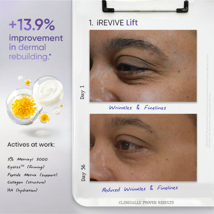 SkinInspired iREVIVE Dual Chamber Under Eye Serum, Brightening & De-Puffing Eye Treatment