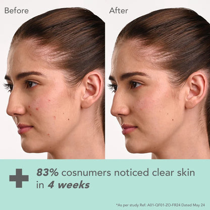 Lotus Dermabotanics Kojic Acid + Multi Berry Ampoule Face Cream pH5.5 Suitable For Sensitive Skin