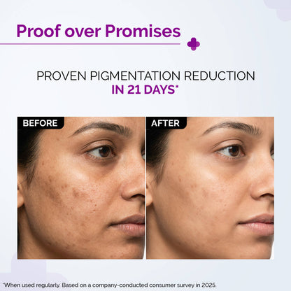 The Derma Co 2% Kojic Acid Face Serum for Dark spots reduction, Pigmentation & Blemishes