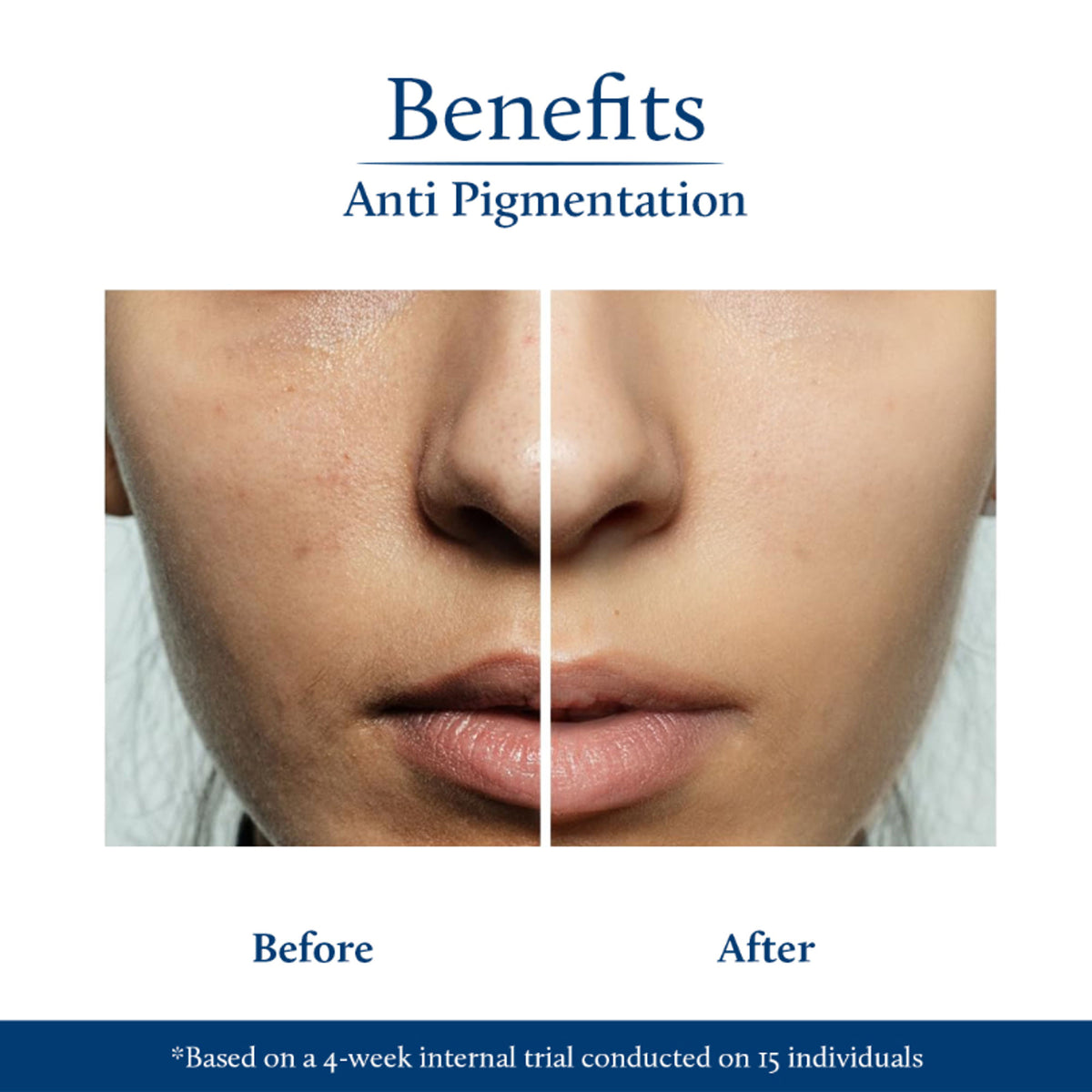 Blue Nectar Kojic Acid Face Serum for pigmentation with rice water and mushroom, shown in a clear glass bottle with dropper.