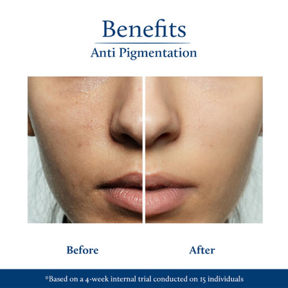 Blue Nectar Kojic Acid Face Serum for pigmentation with rice water and mushroom, shown in a clear glass bottle with dropper.