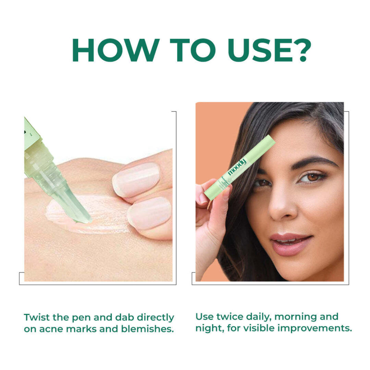 Moody Acnexpert Blemish Fading Pen With Tranexamic & Kojic Acid - For Acne Marks & Scars
