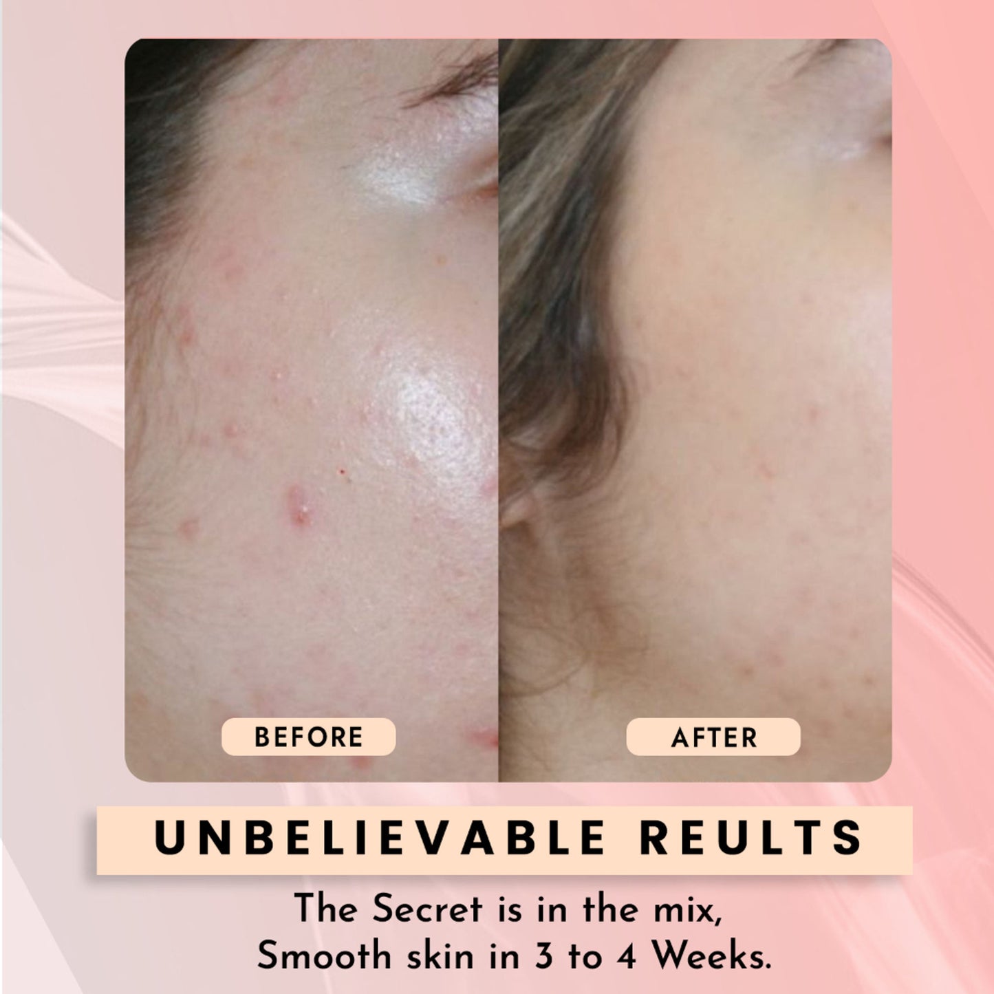 WILDGLOW 10% Niacinamide Face Serum for Pore Minimizing & Even Skin Tone