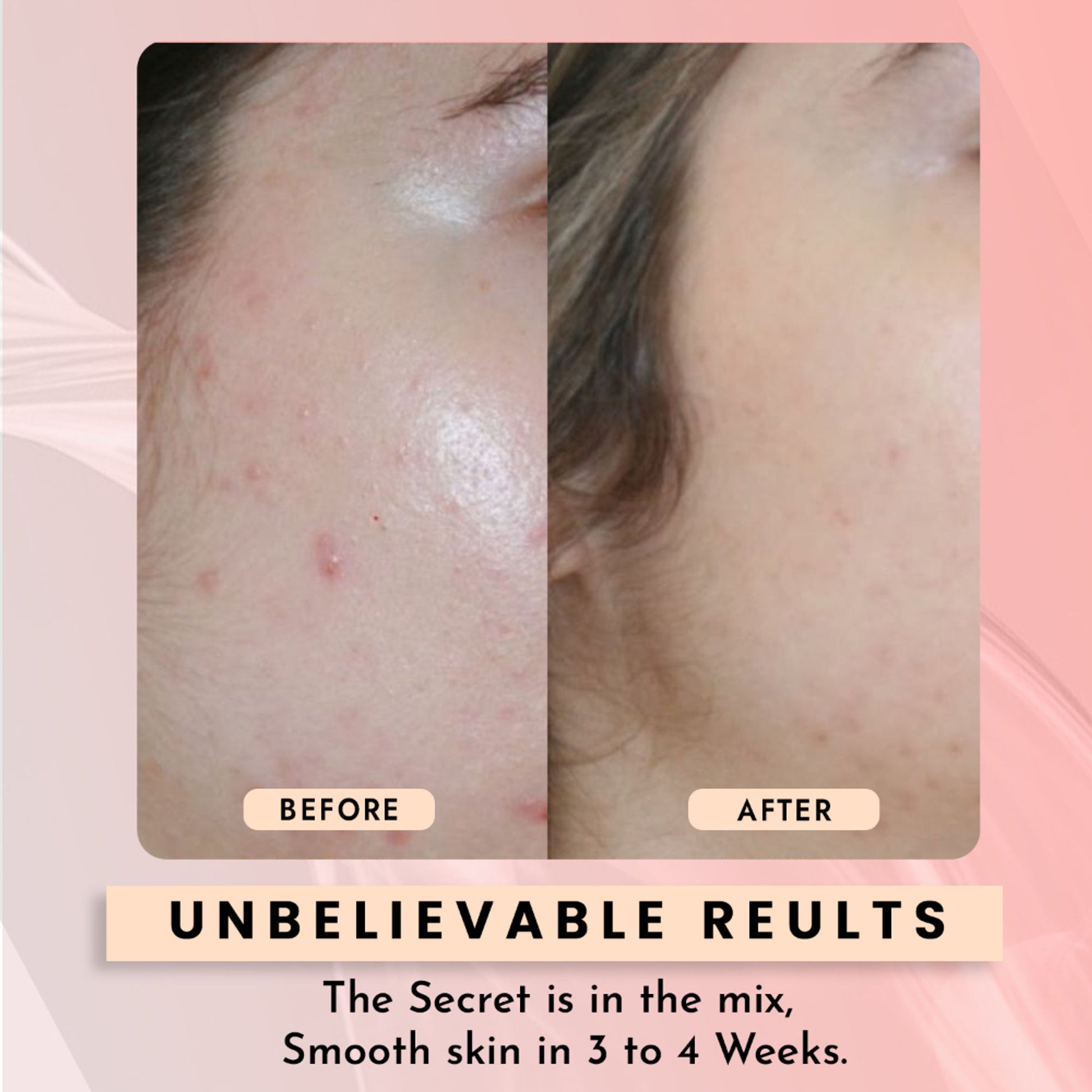 WILDGLOW 10% Niacinamide Face Serum for Pore Minimizing & Even Skin Tone