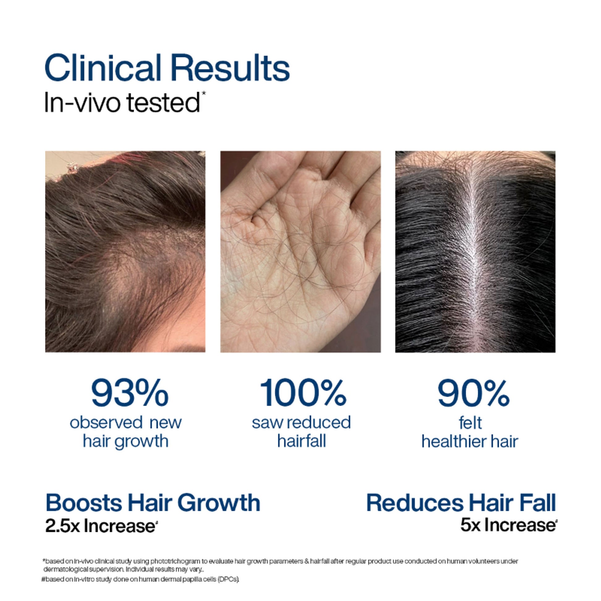 Wishcare Hair Growth Serum Concentrate with Redensyl & Rosemary - In-Vivo Tested - Controls Hairfall