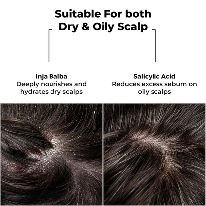 Brillare Dandruff Control Shampoo