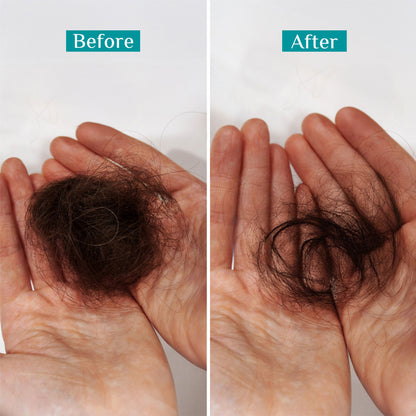 Pilgrim Redensyl & Anagain Hairfall Control Shampoo With Growth Boosters For Thick & Dense Hair