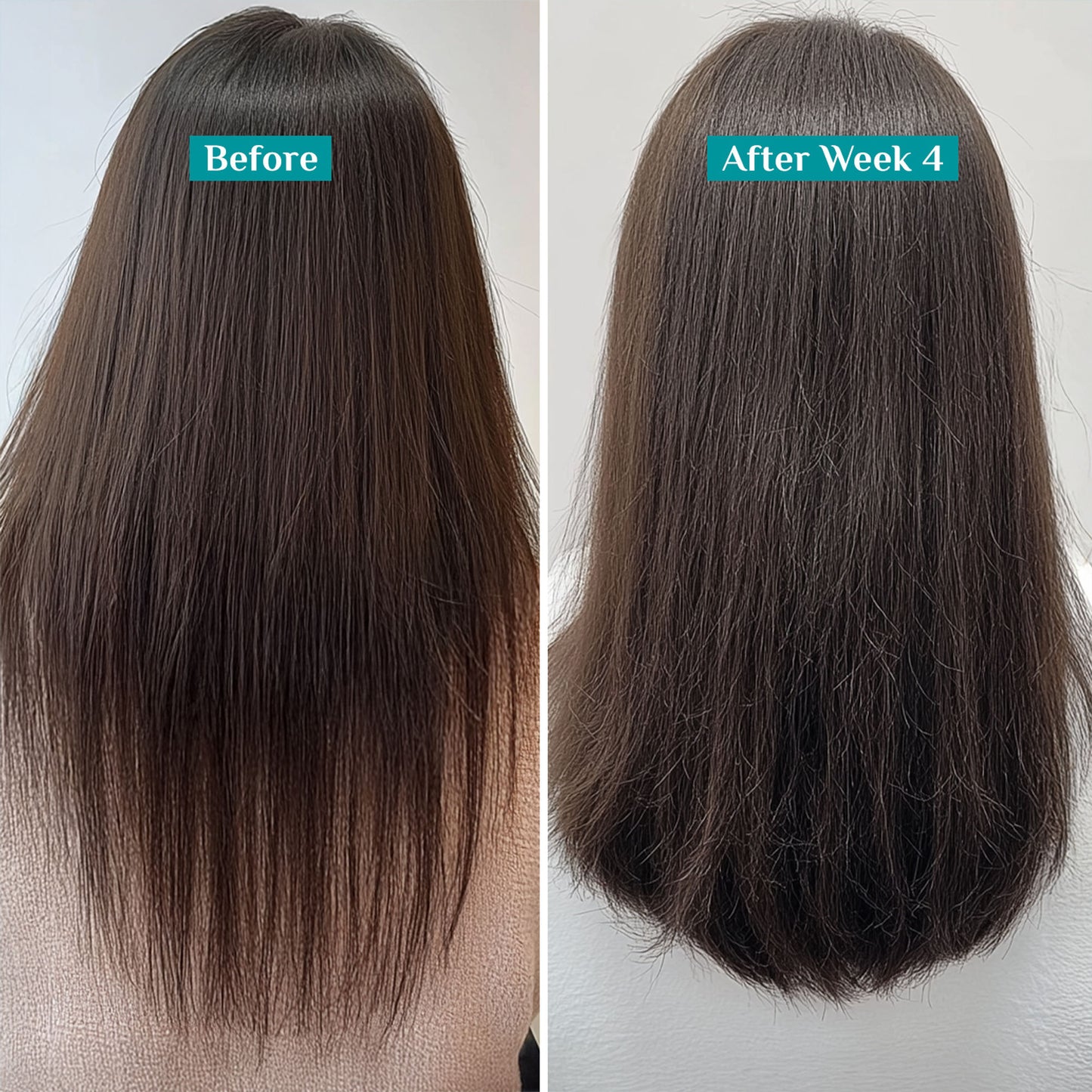 Pilgrim Redensyl & Anagain Hairfall Control Shampoo With Growth Boosters For Thick & Dense Hair