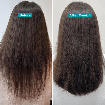 Pilgrim Redensyl & Anagain Hairfall Control Shampoo With Growth Boosters For Thick & Dense Hair