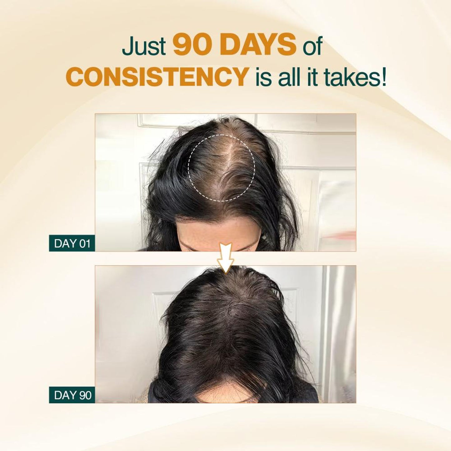 Nourish Mantra Advanced Hair Growth Serum for Hair Regrowth and Prevention of Hair Thinning