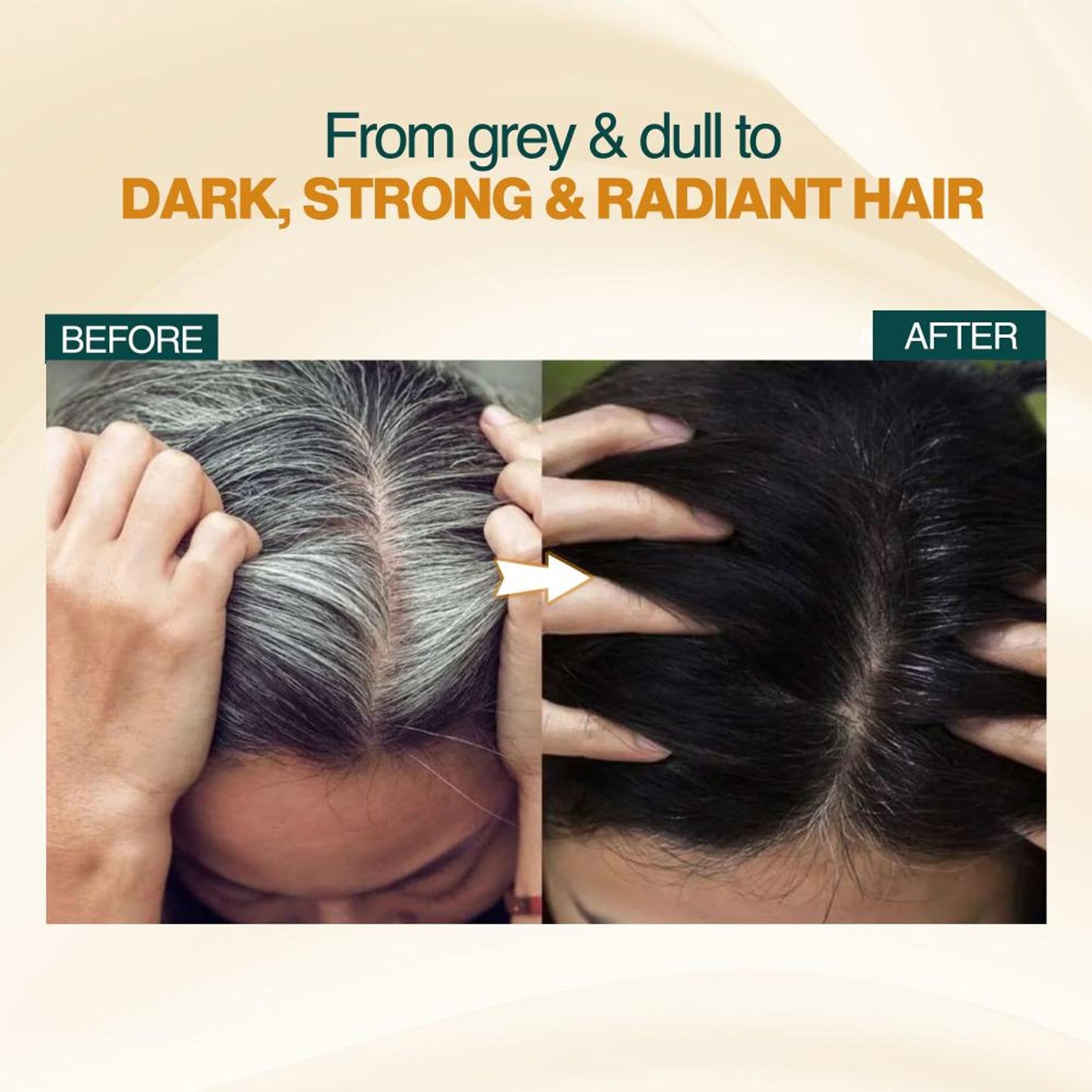 Nourish Mantra Anti-Greying Rice Water Serum to Stop Premature Hair Greying