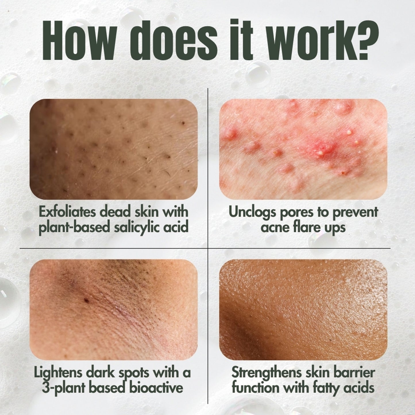 Hibiscus Monkey Ingrown Hair Treatment For Shaving and Waxing Bumps and Ingrown Hair, Dermat-tested