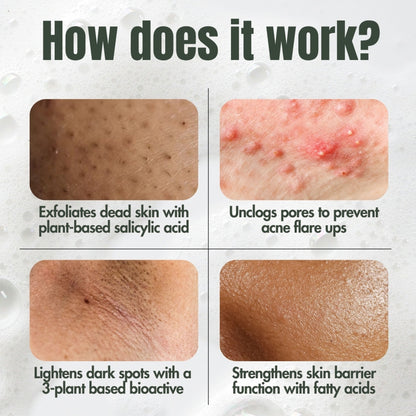 Hibiscus Monkey Ingrown Hair Treatment For Shaving and Waxing Bumps and Ingrown Hair, Dermat-tested