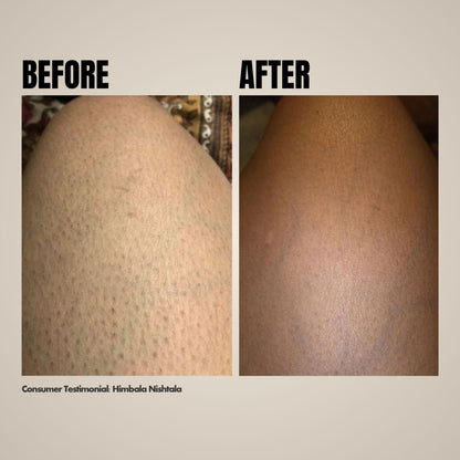 Hibiscus Monkey Ingrown Hair Treatment For Shaving and Waxing Bumps and Ingrown Hair, Dermat-tested