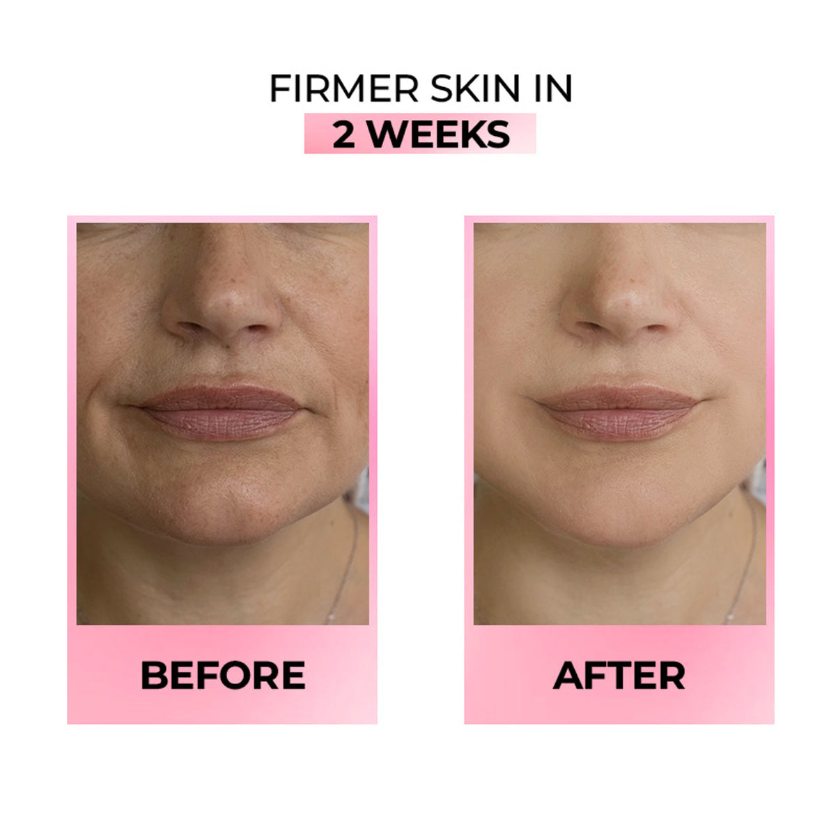 Streax Youthful Shine Face Serum With 11% Retinol Peptide Complex, Reduces Fine Lines & Wrinkles