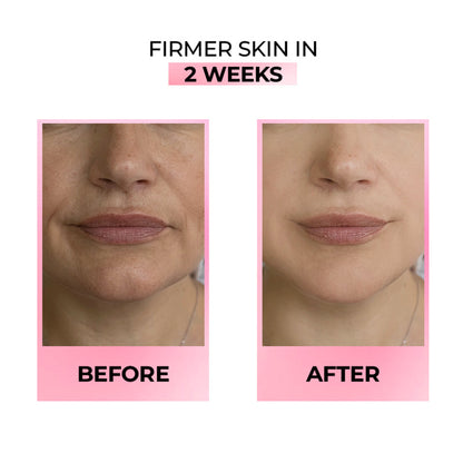 Streax Youthful Shine Face Serum With 11% Retinol Peptide Complex, Reduces Fine Lines & Wrinkles