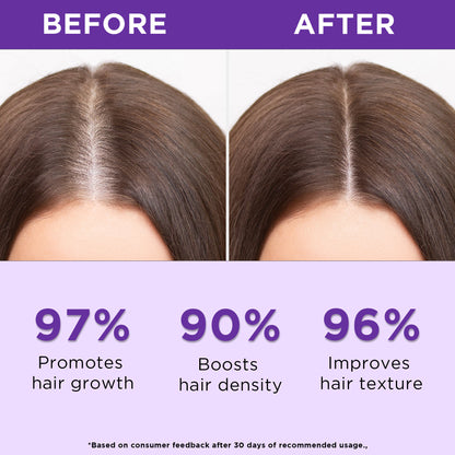 Orgatre 100% Rosemary Water Spray - Hair Growth & Scalp Nourishment Hair Spray