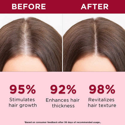 Orgatre Red Onion Water Spray - Hair Fall Control & Hair Growth Spray with 17 Natural Herbs