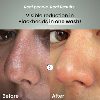 The Solved Skin Ultra Smooth Daily Cleanser
