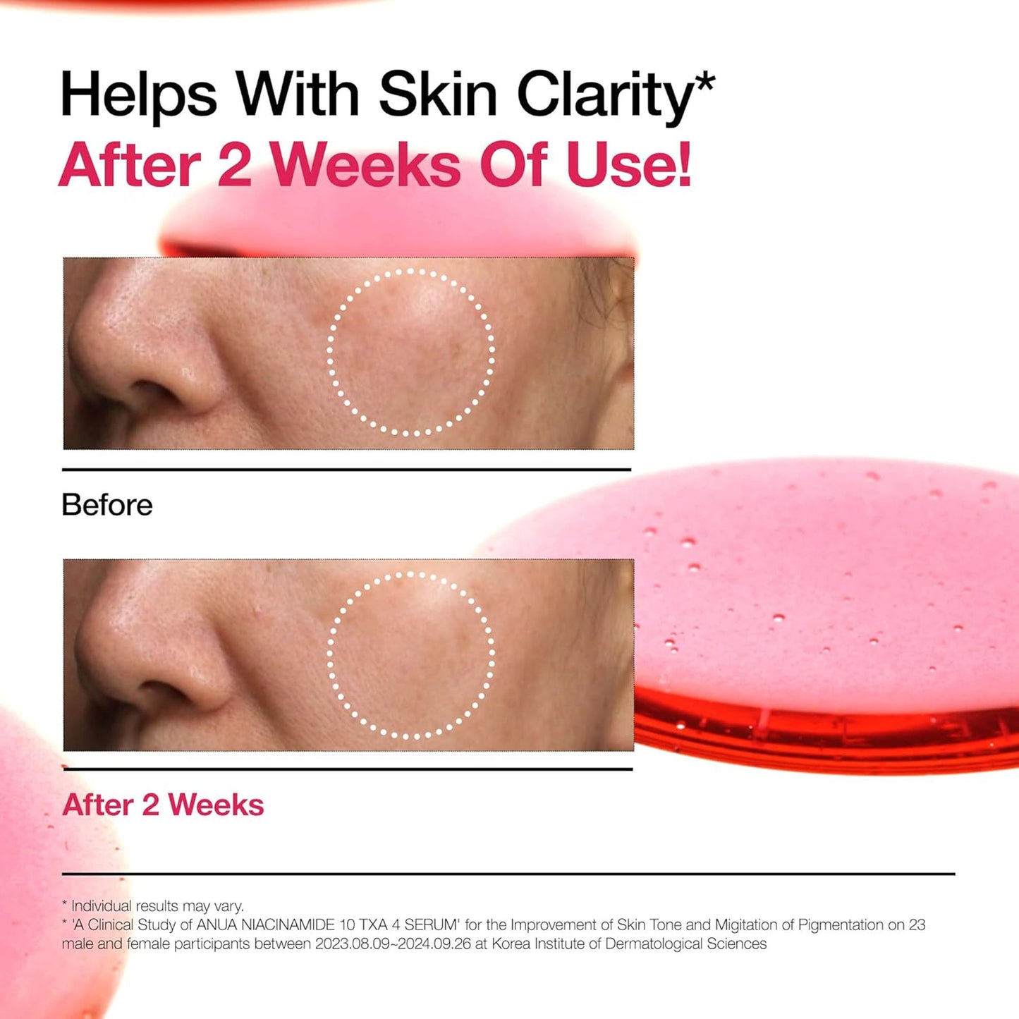 Anua Niacinamide 10 Txa 4 Serum, Brightening Korean Serum For Dark Spots & Hyperpigmentation